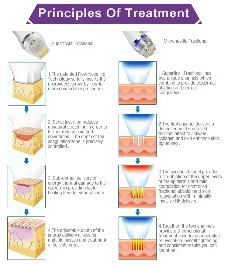 FQB64-G781 RF microneedling principle illustration