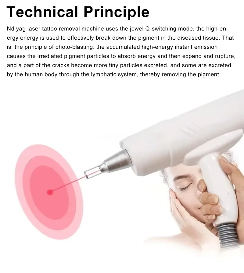FQB66-V245 Laser operating-principle illustration