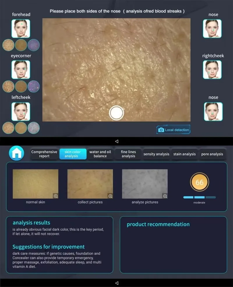 FQB84-G747 Skin-analysis interface reference