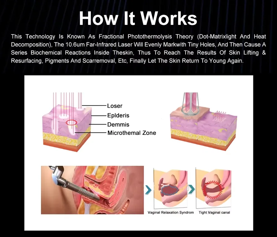 FQC3-V263 Fractional scanning principle illustration