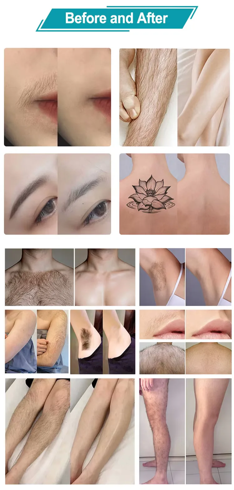 Hair and tattoo appearance comparison artwork supplied for the FQC9-G769 product
